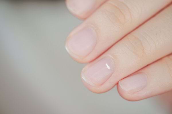 une main avec des ongles qui ont une tache blanche