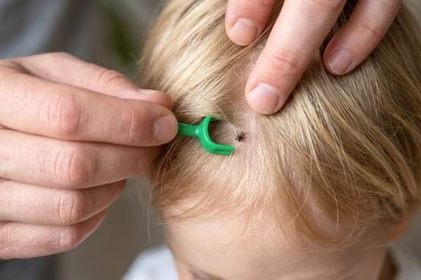 un adulte utilisant un tire-tique vert en plastique pour retirer un parasite