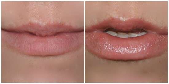 how to make your lips fuller fast