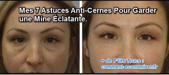 effacer les cernes avant et après