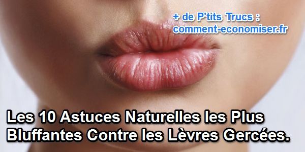 astuces naturelles contre les lèvres gercées