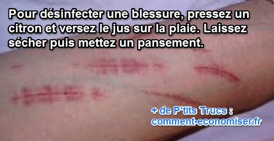 désinfecter une blessure, coupure avec citron