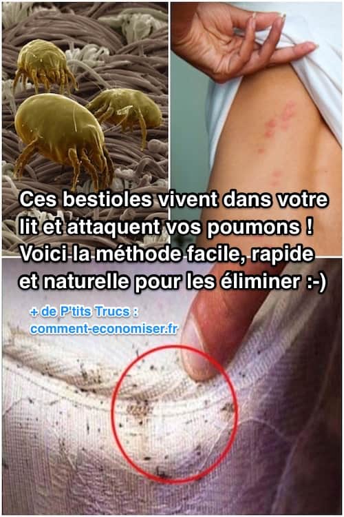 Les acariens vivent dans votre lit : comment faire pour s'en débarrasser ?