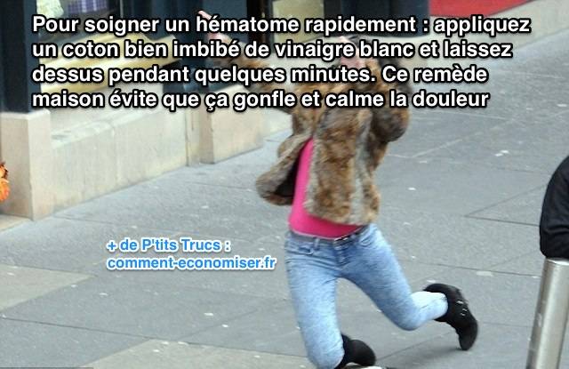 Comment soigner un hématome, bleu ou bosse avec du vinaigre blanc