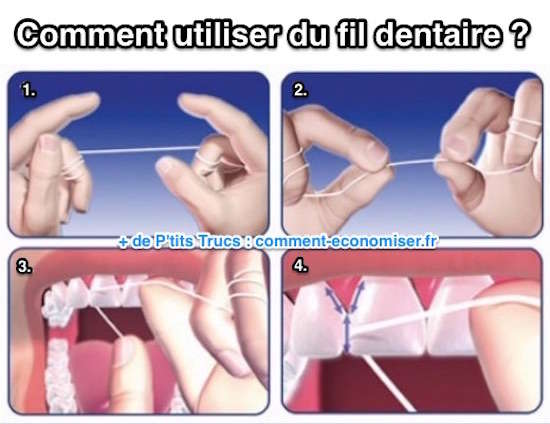 Astuce pour utiliser fil dentaire