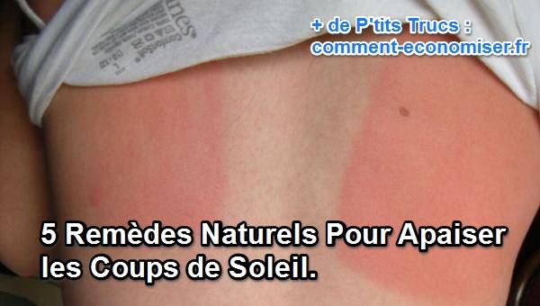 5 Remèdes Naturels Pour Apaiser les Coups de Soleil.