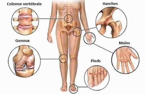 La déshydratation cause des douleurs articulaires