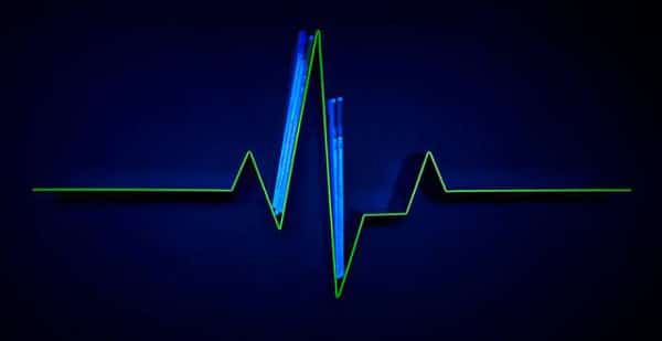 Étagère à palpitations