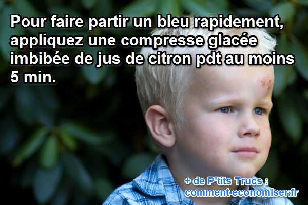 pour faire partir un bleu rapidement appliquez une compresse de citron glacée