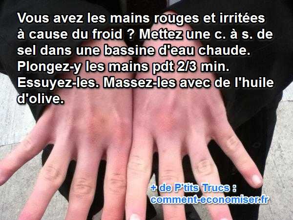 Mains Rouges et Irritées à Cause du Froid ? Voici le Remède Efficace.