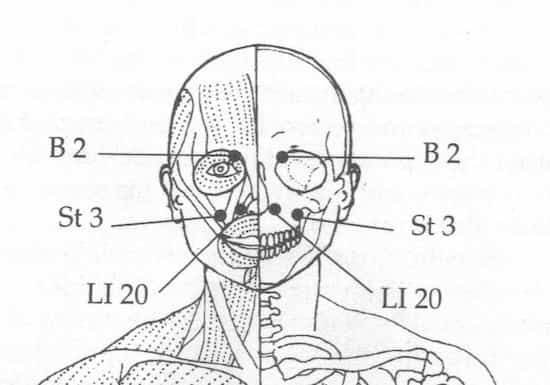 Diagramme des points d'acupression pour soulager les douleurs des sinus liées au rhume banal.
