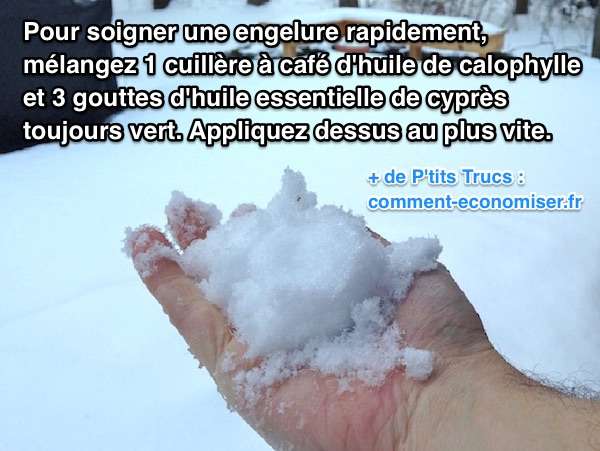 Rem&egrave;de maison et rapide pour soigner une engelure
