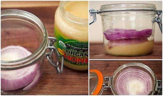 Remède de sirop maison contre le rhume dans un bocal avec des oignons et du miel.