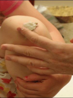 argile de bentonite en cataplasme pour les petits bobos