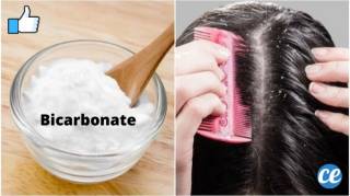 Le Bicarbonate de Soude : L'Astuce Naturelle et Efficace Contre les Pellicules
