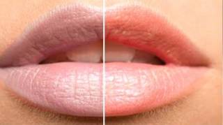 Lèvres Noircies Par la Cigarette  3 Remèdes Pour les Détacher en 1 Semaine