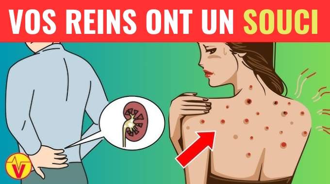 10 Signes que Vous Avez un Problème aux Reins (à Ne Pas Ignorer).