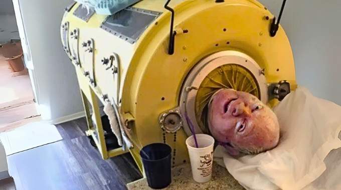Un Homme de 76 ans, Paralysé par la Polio à l’Âge de 6 ans, Était l’un des Derniers à Vivre avec un Poumon en Acier.