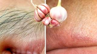 Voici Comment se Débarrasser Définitivement des Poils du Visage et du Corps
