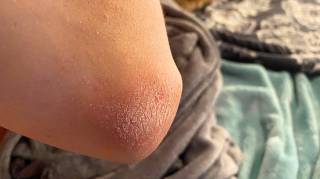Si vos Coudes sont Secs Voici ce que votre Corps Essaie de Vous Dire (et vous Devriez y Prêter Attention)