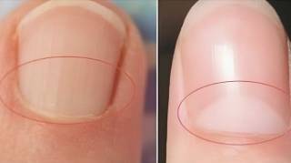 Que Signifie la Demi-Lune Blanche à la Base de l'Ongle