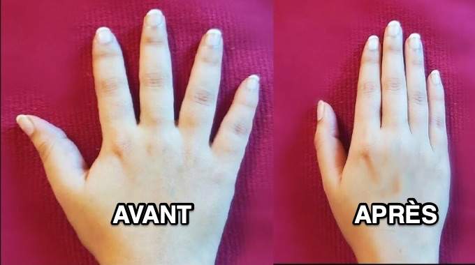 Comment maigrir des doigts pour avoir de belles mains fines et élégantes