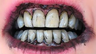 Comment blanchir ses dents en 3 minutes grâce au mélange citron-charbon