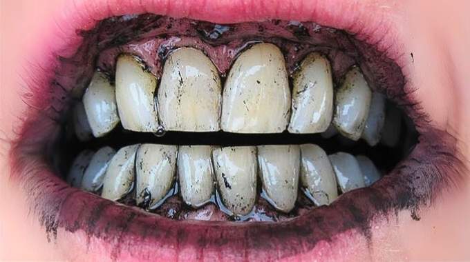 Comment blanchir ses dents en 3 minutes grâce au mélange citron-charbon