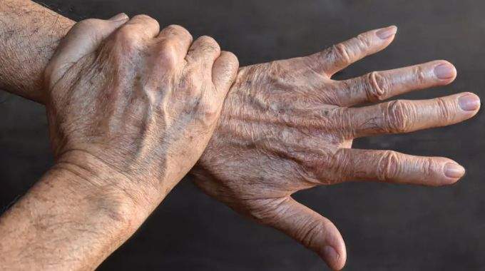 La carence en ce minéral provoque l’apparition des taches de vieillesse