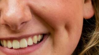 La signification secrète des fossettes que la plupart des gens ignorent