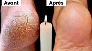 Avec une bougie débarrassez-vous des talons crevassés en seulement 1 jour