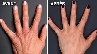 Comment rajeunir ses mains naturellement
