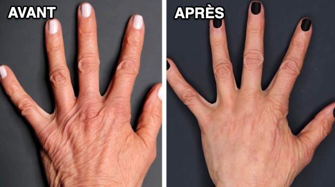 Comment rajeunir ses mains naturellement ?