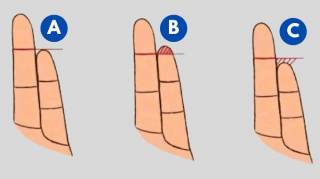 La longueur de votre petit doigt r&eacute;v&egrave;le un trait de personnalit&eacute; inattendu