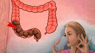 Avec une cuill&egrave;re &agrave; soupe le matin il d&eacute;loge tous les cacas pendant 7 jours en 3 heures (et nettoie le c&ocirc;lon)