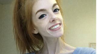 Cette jeune femme n'a mang&eacute; qu'un morceau de pain par jour pendant 5 ans Prenez un mouchoir avant de la voir aujourd'hui