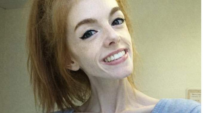 Cette jeune femme n'a mang&eacute; qu'un morceau de pain par jour pendant 5 ans. Prenez un mouchoir avant de la voir aujourd'hui...