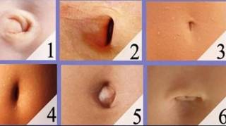 Que r&eacute;v&egrave;le la forme de votre nombril sur votre personnalit&eacute;