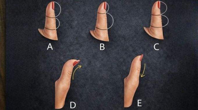 La forme du pouce en dit long