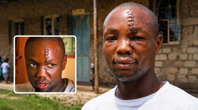 Anthony Omari : seul face &agrave; des assaillants arm&eacute;s de machettes, il sauve 37 orphelins malgr&eacute; un coup de machette au visage