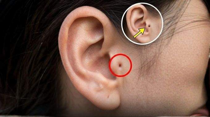 Connaissez-vous quelqu'un avec cette marque &agrave; l'oreille ? Voici ce que cela signifie