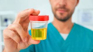 Les diff&eacute;rentes couleurs d'urine et leur signification