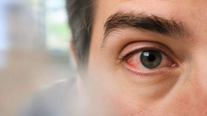 AVC de l'&oelig;il: ce sympt&ocirc;me peut vous faire perdre la vue en quelques heures
