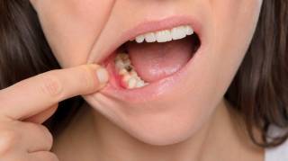 Comment calmer une rage de dents rapidement  7 rem&egrave;des de grand-m&egrave;re efficaces