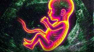 Des chercheurs pensent avoir identifi&eacute; l'une des causes possibles de l'autisme