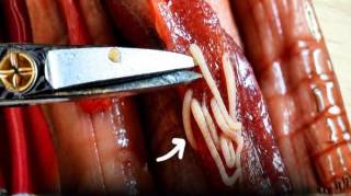 5 aliments courants particuli&egrave;rement riches en parasites et qu'on mange presque tous les jours