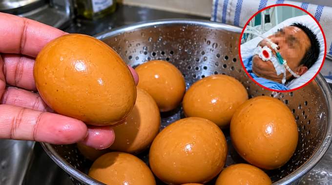 Un homme de 42 ans meurt apr&egrave;s avoir mang&eacute; des &oelig;ufs : les m&eacute;decins alertent sur les dangers r&eacute;els d'une habitude alimentaire encore tr&egrave;s r&eacute;pandue