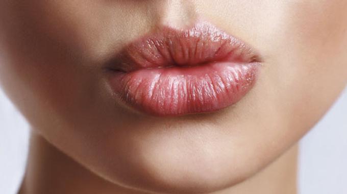 Les 10 Astuces Naturelles les Plus Bluffantes Contre les Lèvres Gercées.