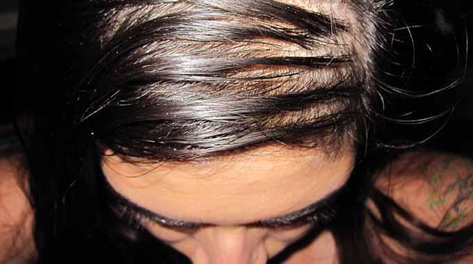 Les 3 Astuces Qui Marchent Pour Ne Plus Avoir Les Cheveux Gras.