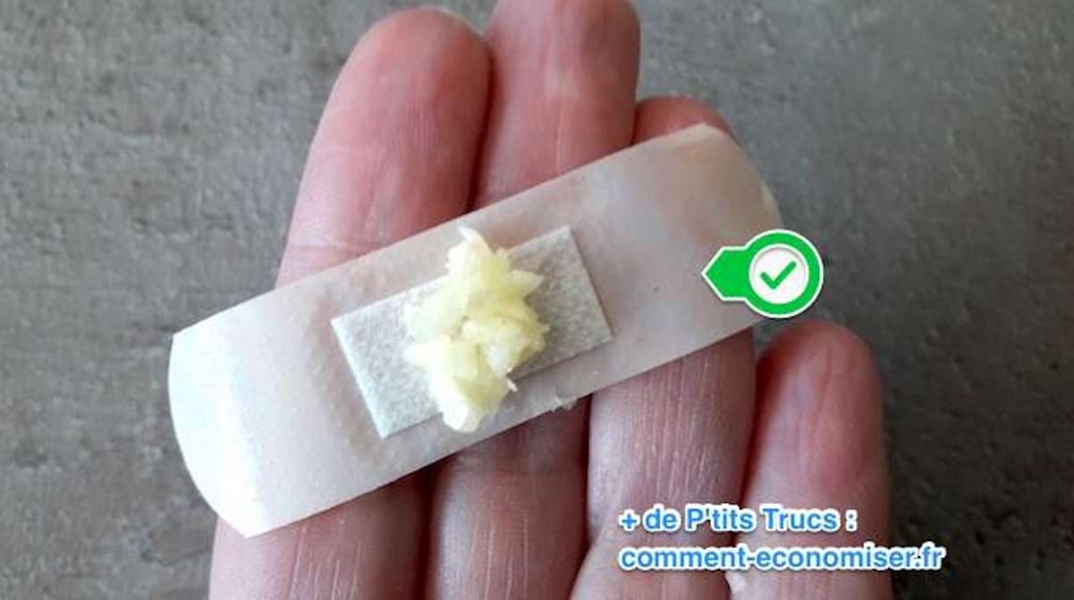 Le Remede Ancestral Pour Enlever Une Verrue Avec De L Ail Rapidement